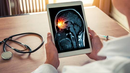 Doctor looking at a brain scan